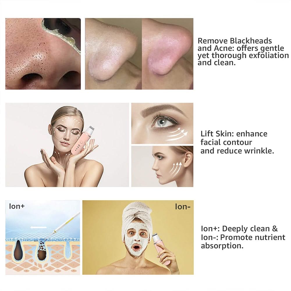 Bienelia™ Exfoliador ultrasónico para eliminar puntos negros