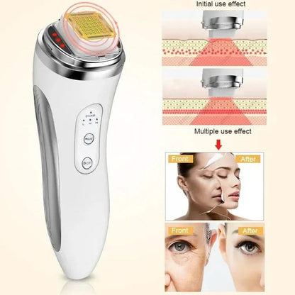 Bienelia™ Dispositivo facial de matriz de puntos para reafirmar y rejuvenecer la piel