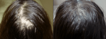 Sérum para el crecimiento y contra la caída del cabello
