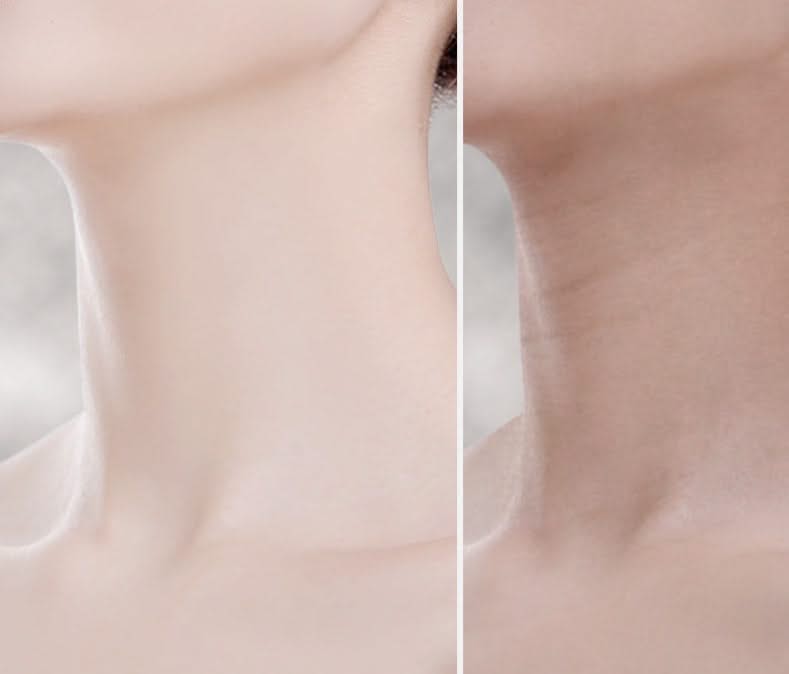 Bienelia™ Masajeador EMS para lifting facial y de cuello