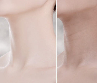 Bienelia™ Masajeador EMS para lifting facial y de cuello