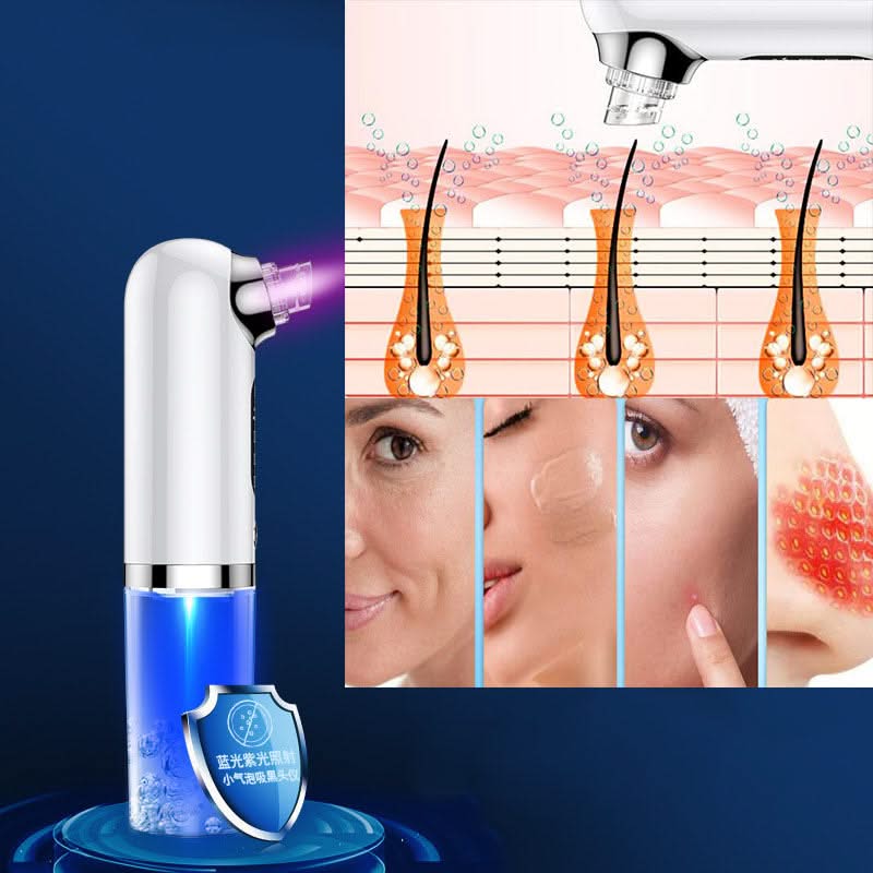 Bienelia™ Limpiador facial Hydro de microdermoabrasión