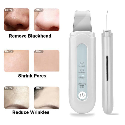 Bienelia™ Limpiador facial ultrasónico de poros