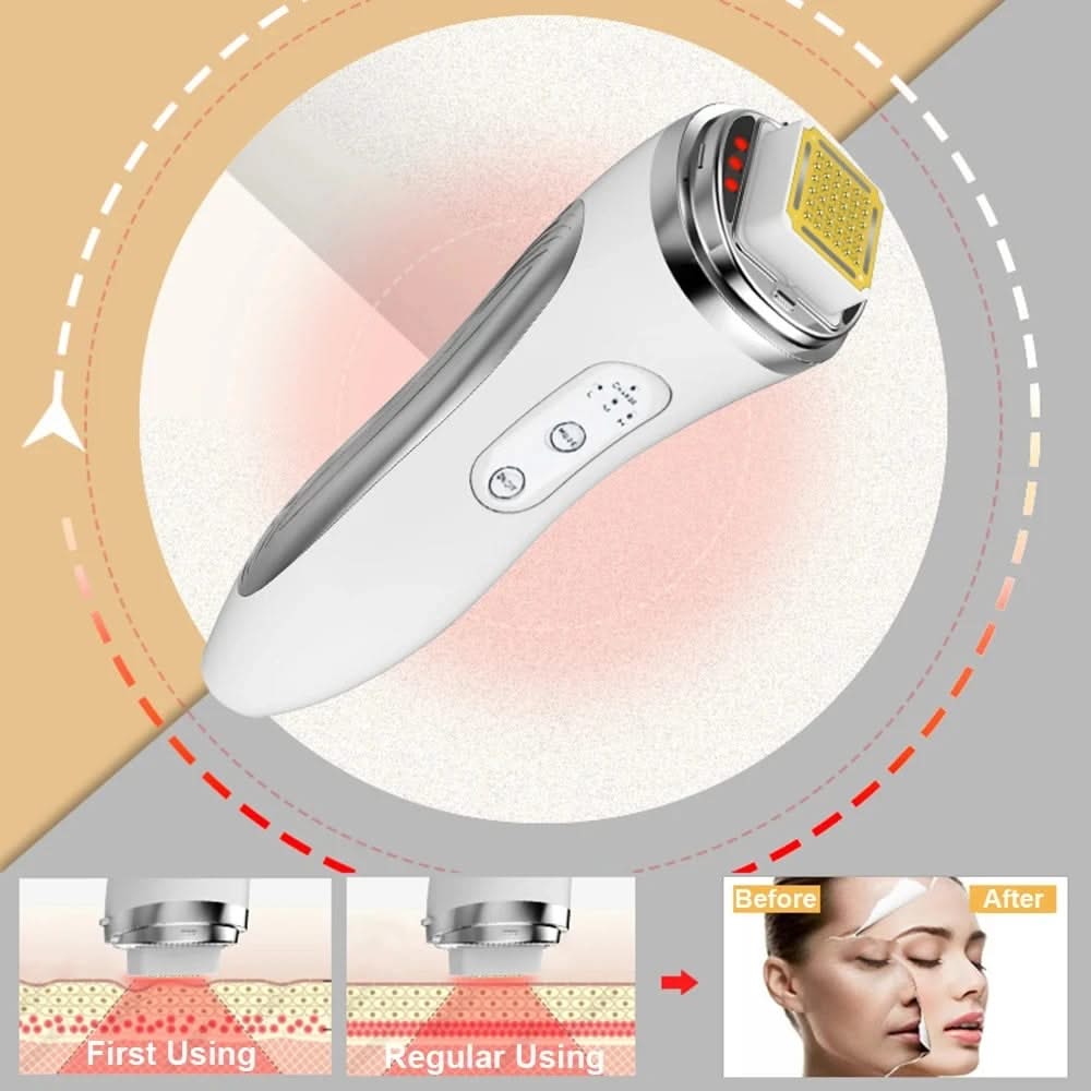 Bienelia™ Dispositivo facial de matriz de puntos para reafirmar y rejuvenecer la piel