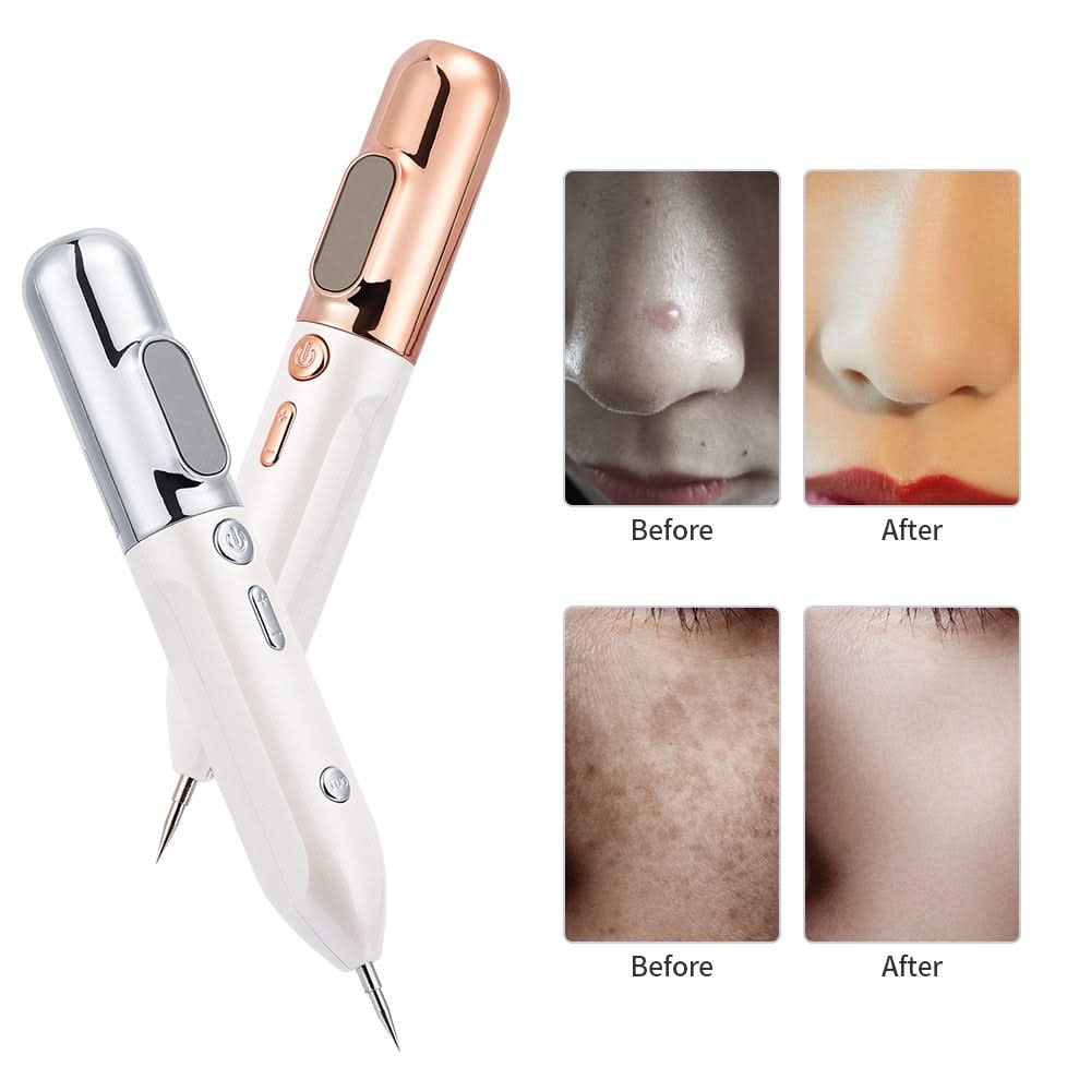 Bienelia™ Lápiz de plasma para eliminar lunares y acrocordones