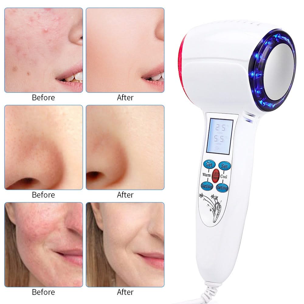 Bienelia™ Dispositivo facial de crioterapia para el hogar