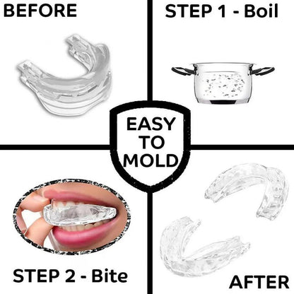 Bienelia™ Protector bucal para ATM y dolor mandibular