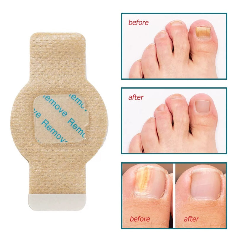 Bienelia™ Parches de hidrogel para reparar las uñas (21 unidades)