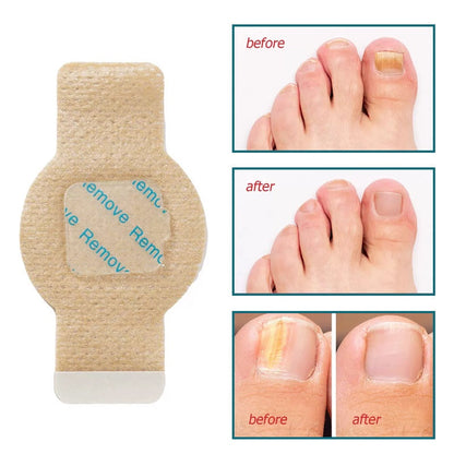 Bienelia™ Parches de hidrogel para reparar las uñas (21 unidades)