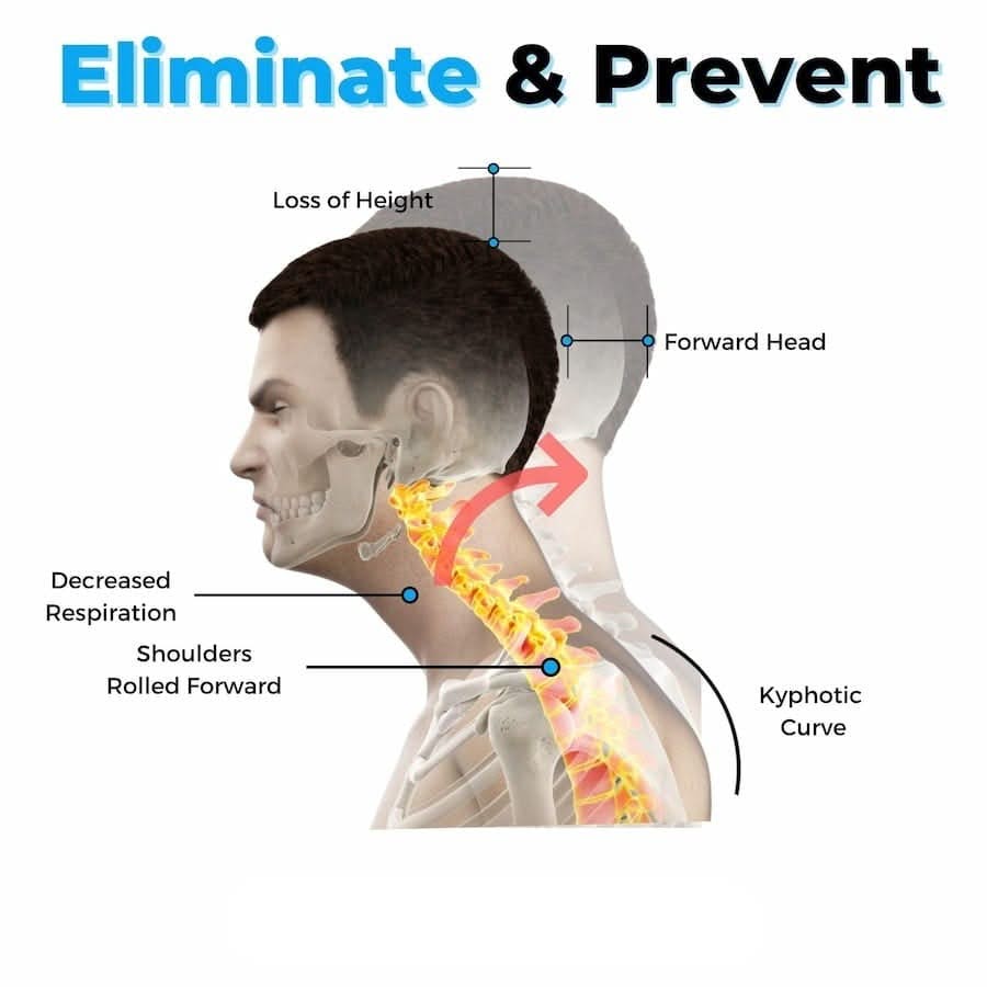 Bienelia™ Estirador cervical para aliviar el dolor de cuello