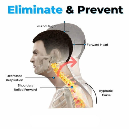 Bienelia™ Estirador cervical para aliviar el dolor de cuello