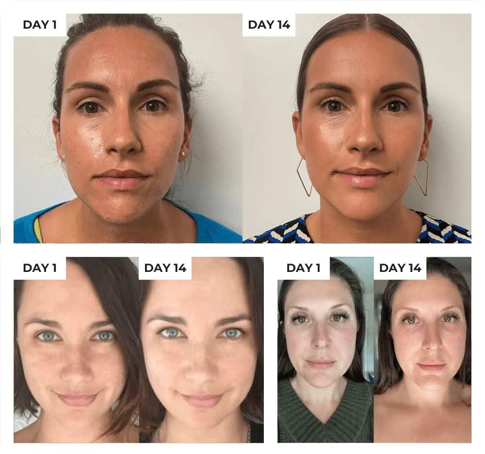 Bienelia™ Dispositivo antiedad para el cuidado de la piel