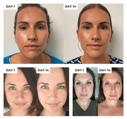 Bienelia™ Dispositivo antiedad para el cuidado de la piel